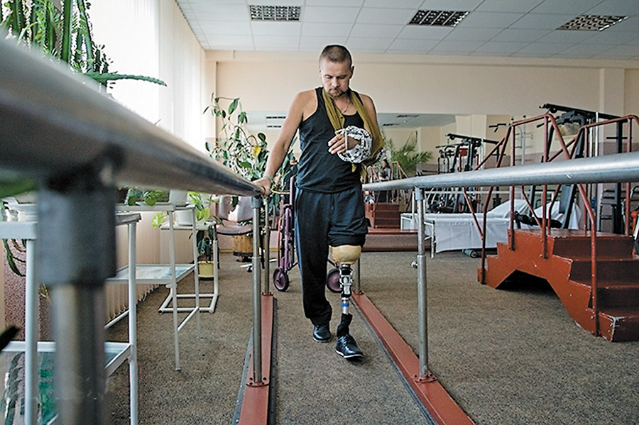 Українські протезні вироби інваліди можуть отримати безкоштовно. Фото з сайту vgolos.com.ua